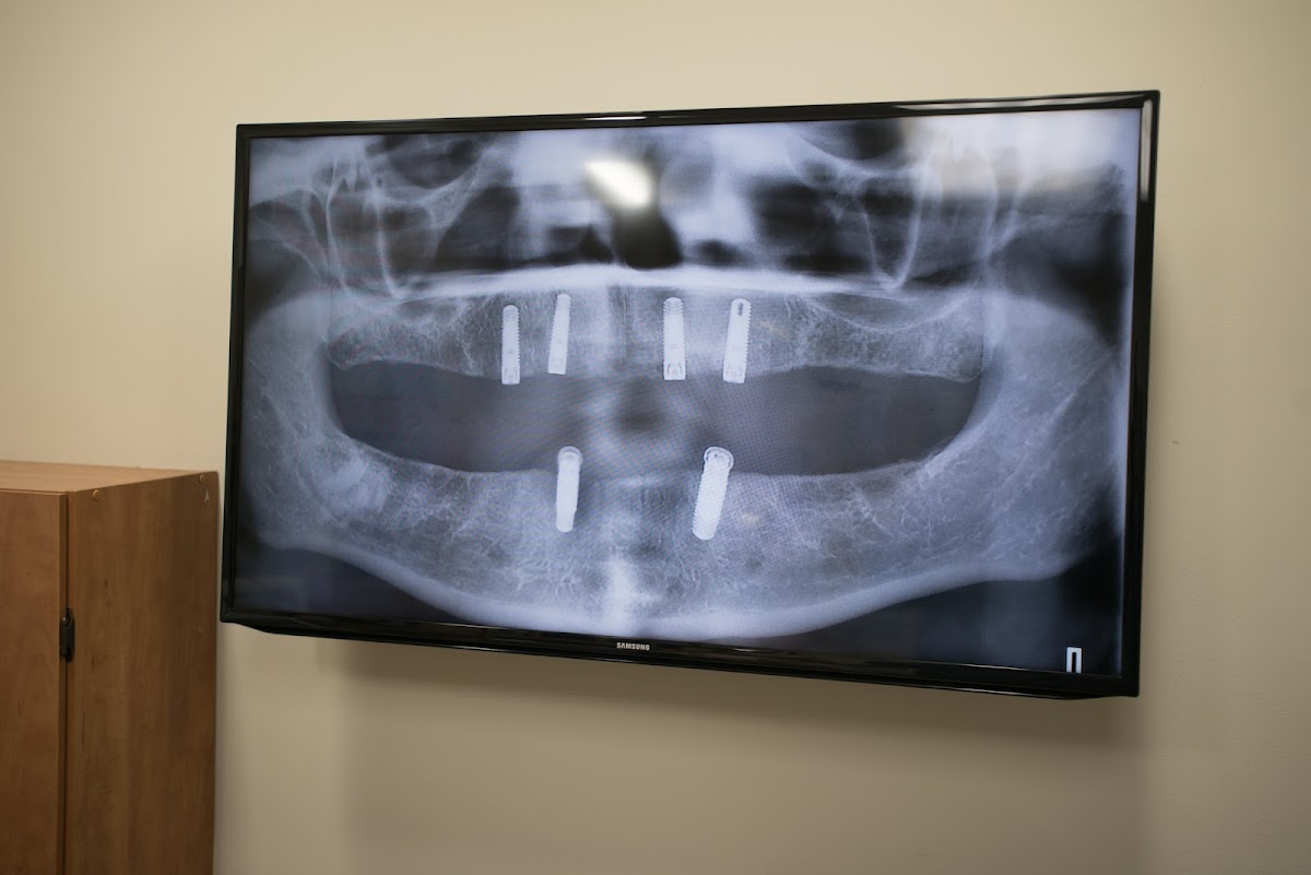 Smile Center Buffalo, Ny photo 3