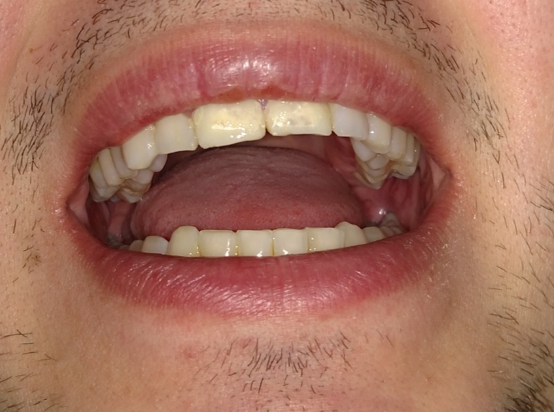 Smile Center Buffalo, Ny photo 4