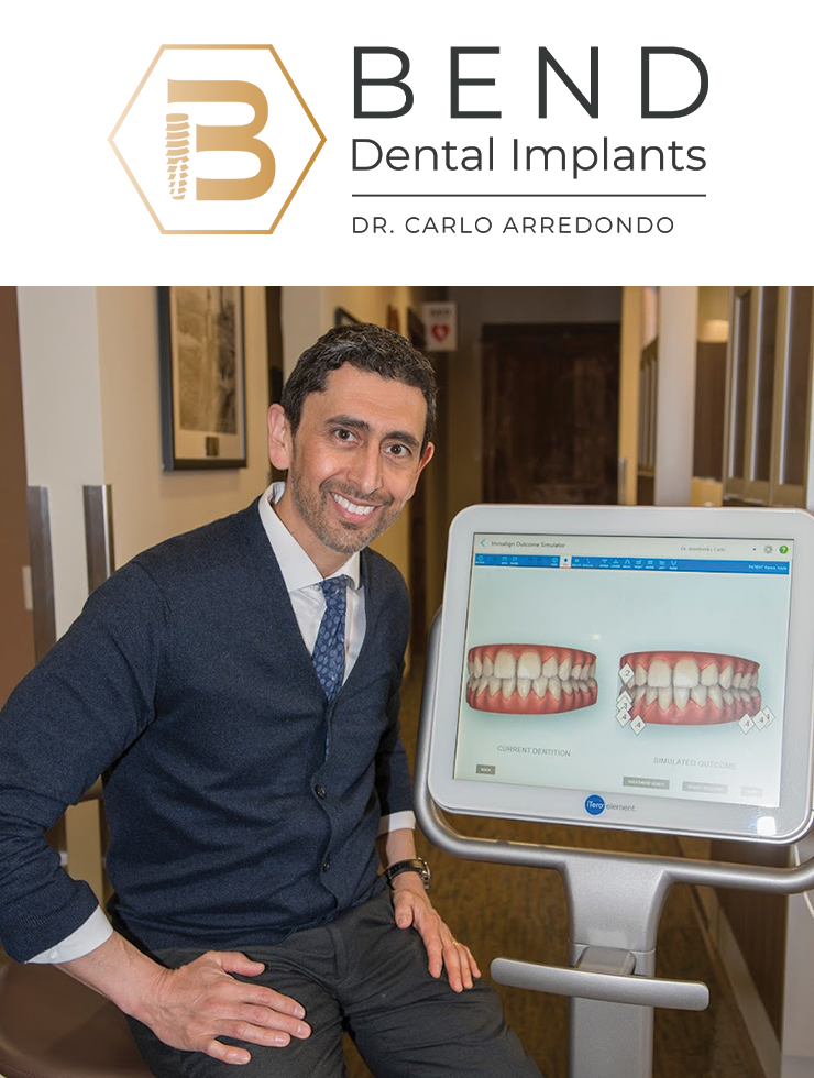 Bend Dental Implants photo 5
