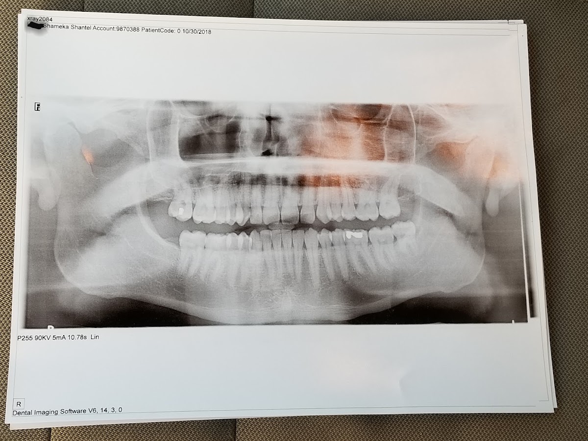 Aspen Dental - Macon photo 2