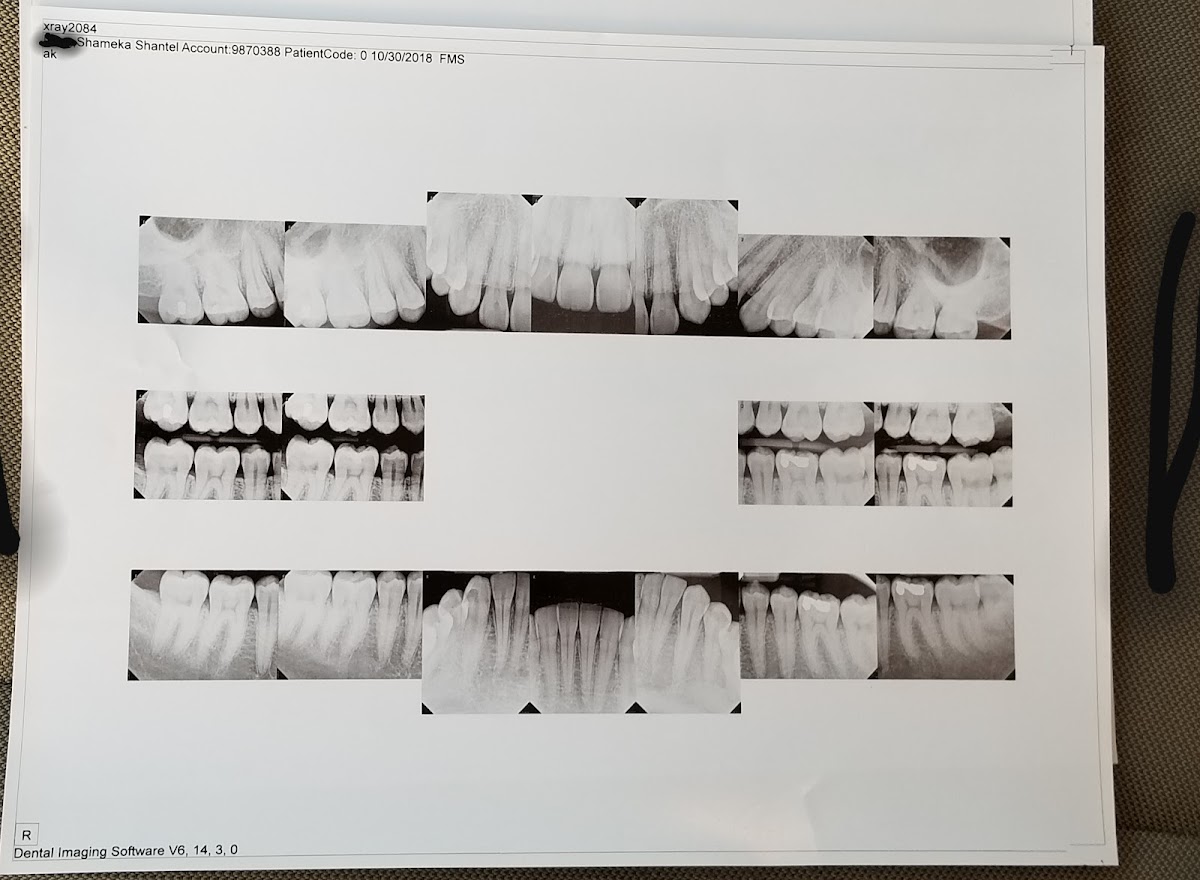 Aspen Dental - Macon photo 6
