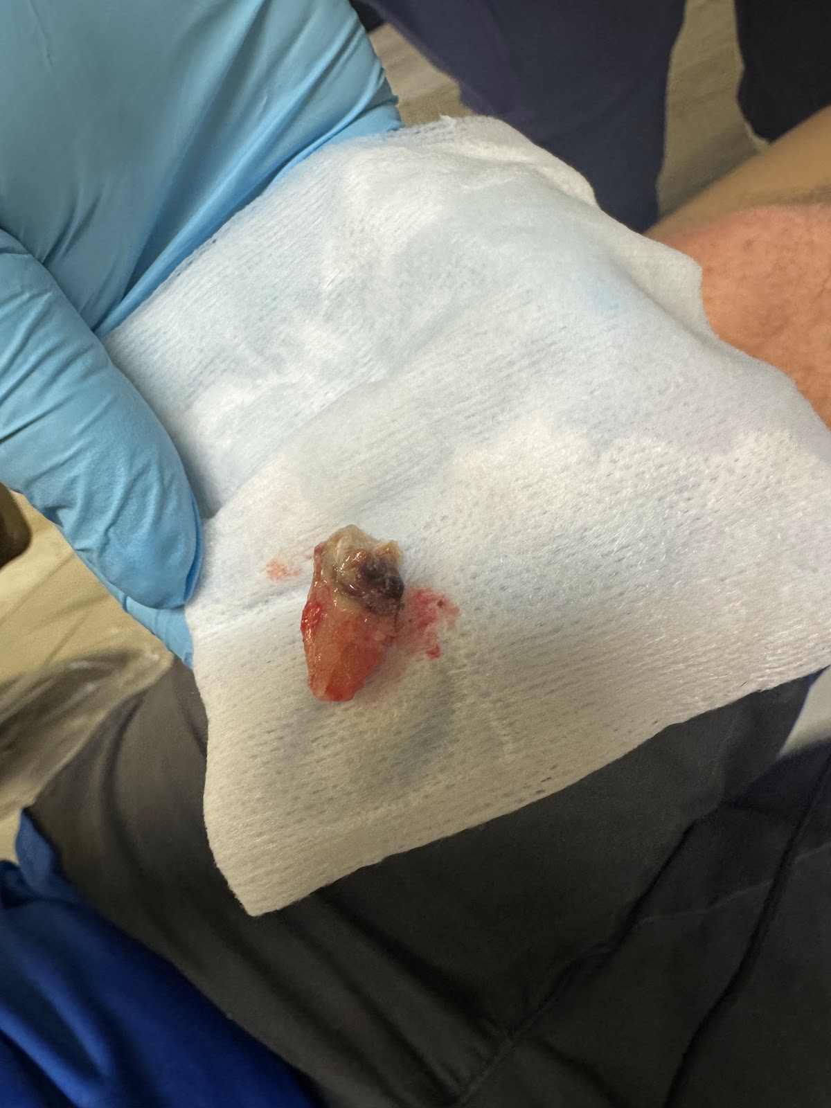 Affordable Dentures & Implants - Pensacola photo 6