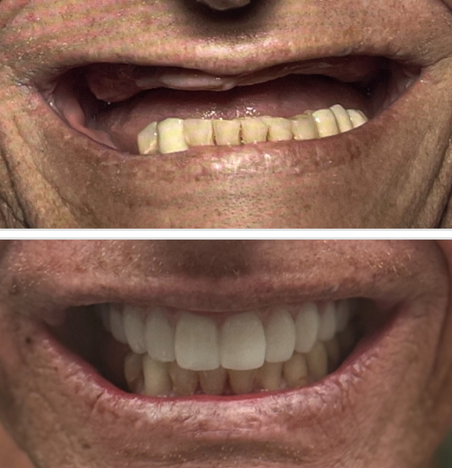 24 Hour Smiles Dental Implant Center photo 4