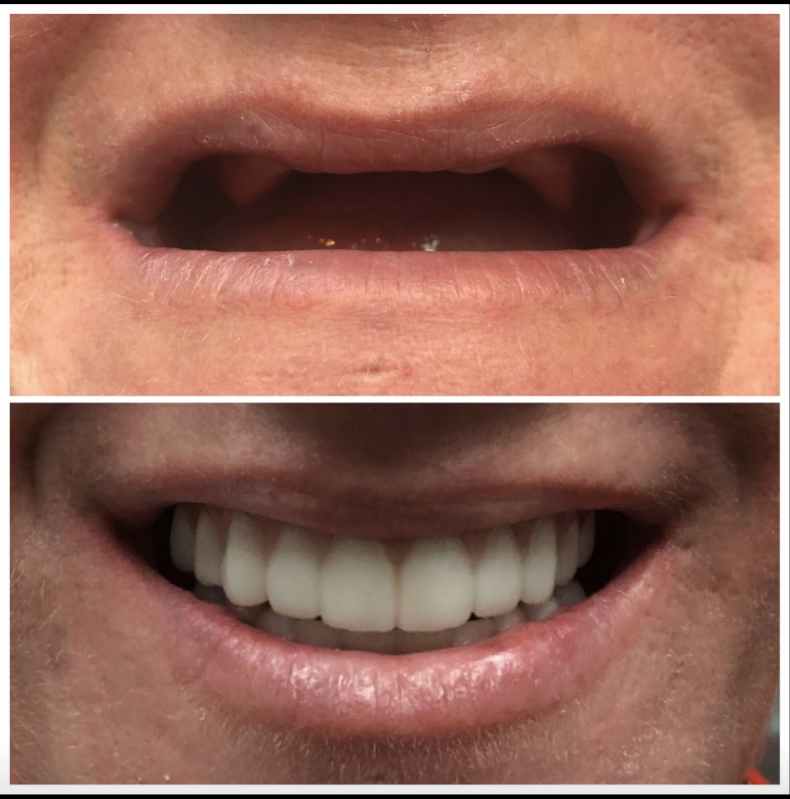 24 Hour Smiles Dental Implant Center photo 5