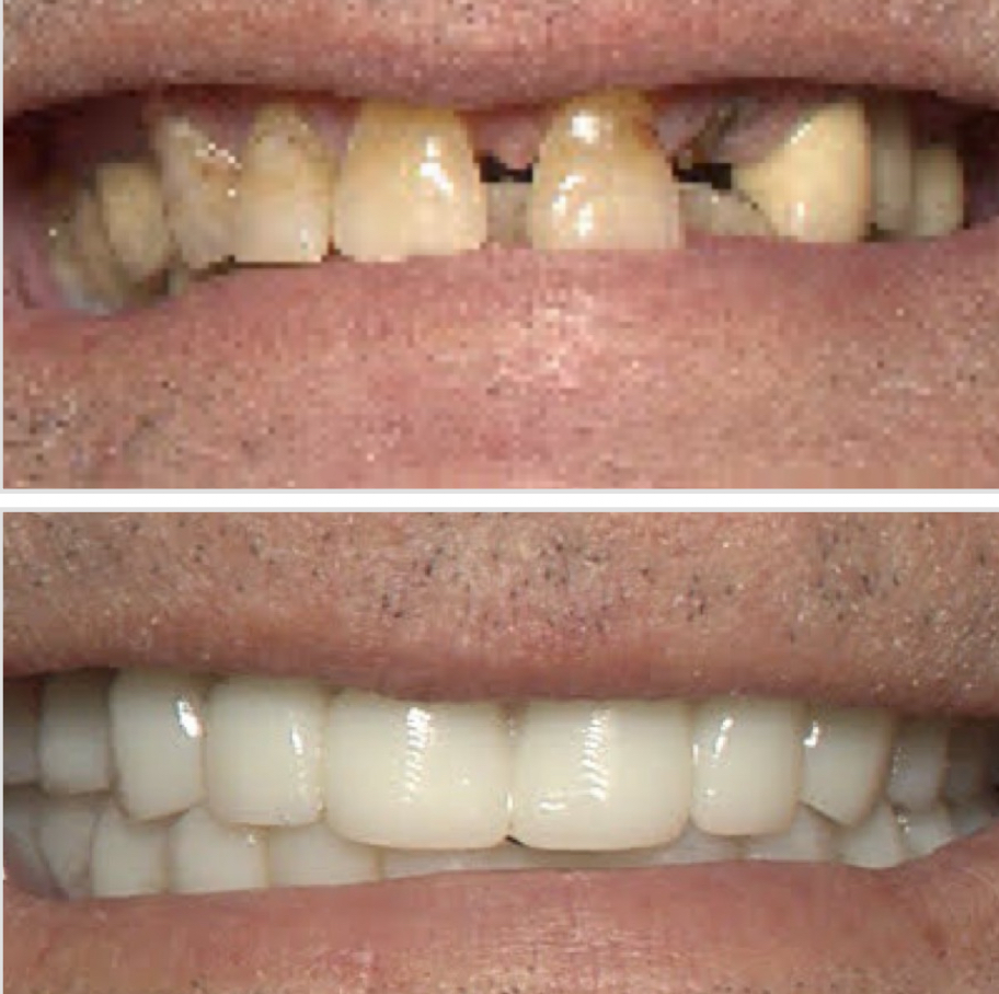 24 Hour Smiles Dental Implant Center photo 6