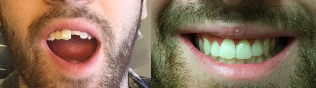 Cosmetic and Implant Dentistry of Connecticut photo 4