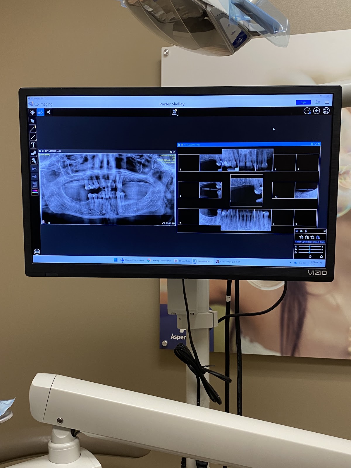 Aspen Dental - Port Orange photo 3
