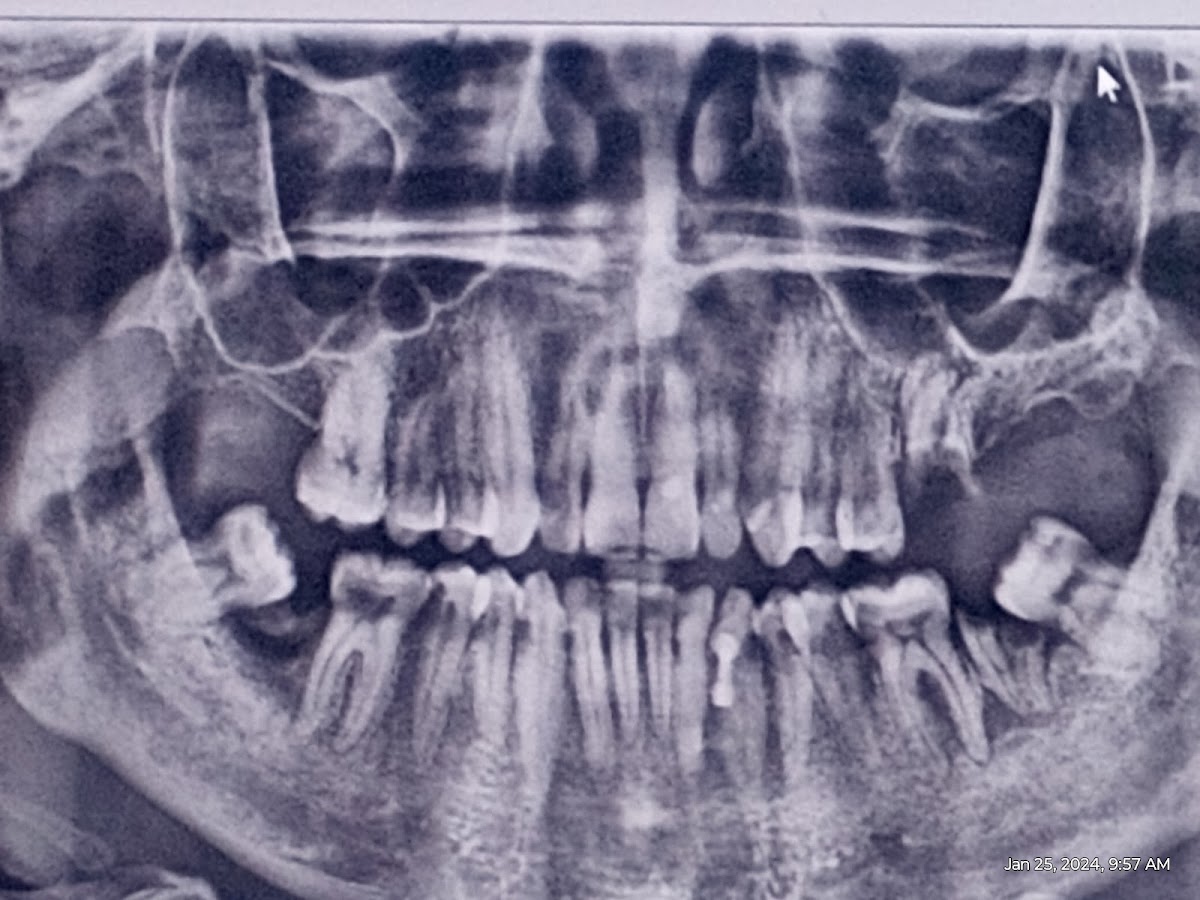 Quality Dental Care Jonathan Mims, DMD photo 6
