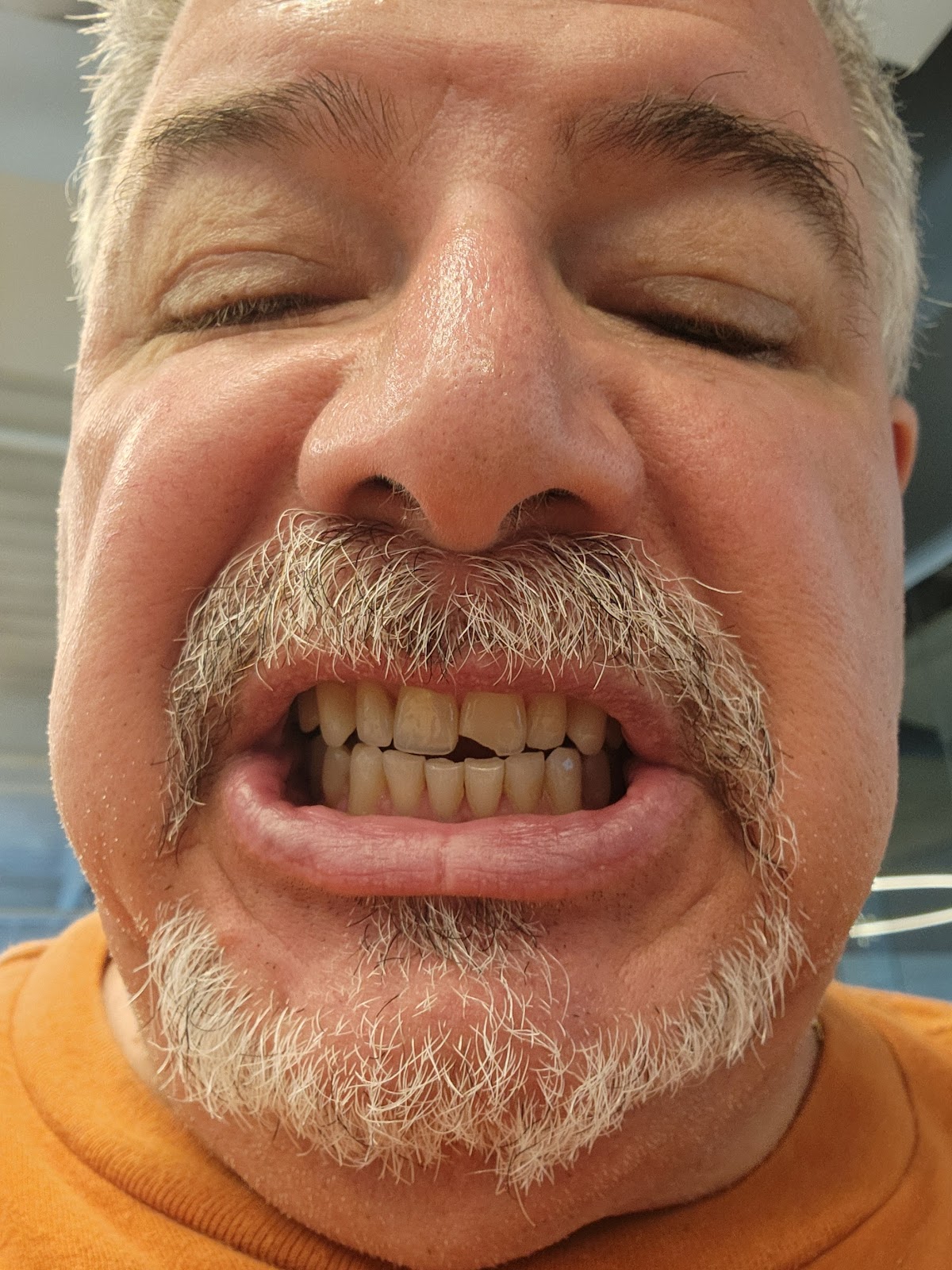 Aspen Dental - Cranberry Township photo 6