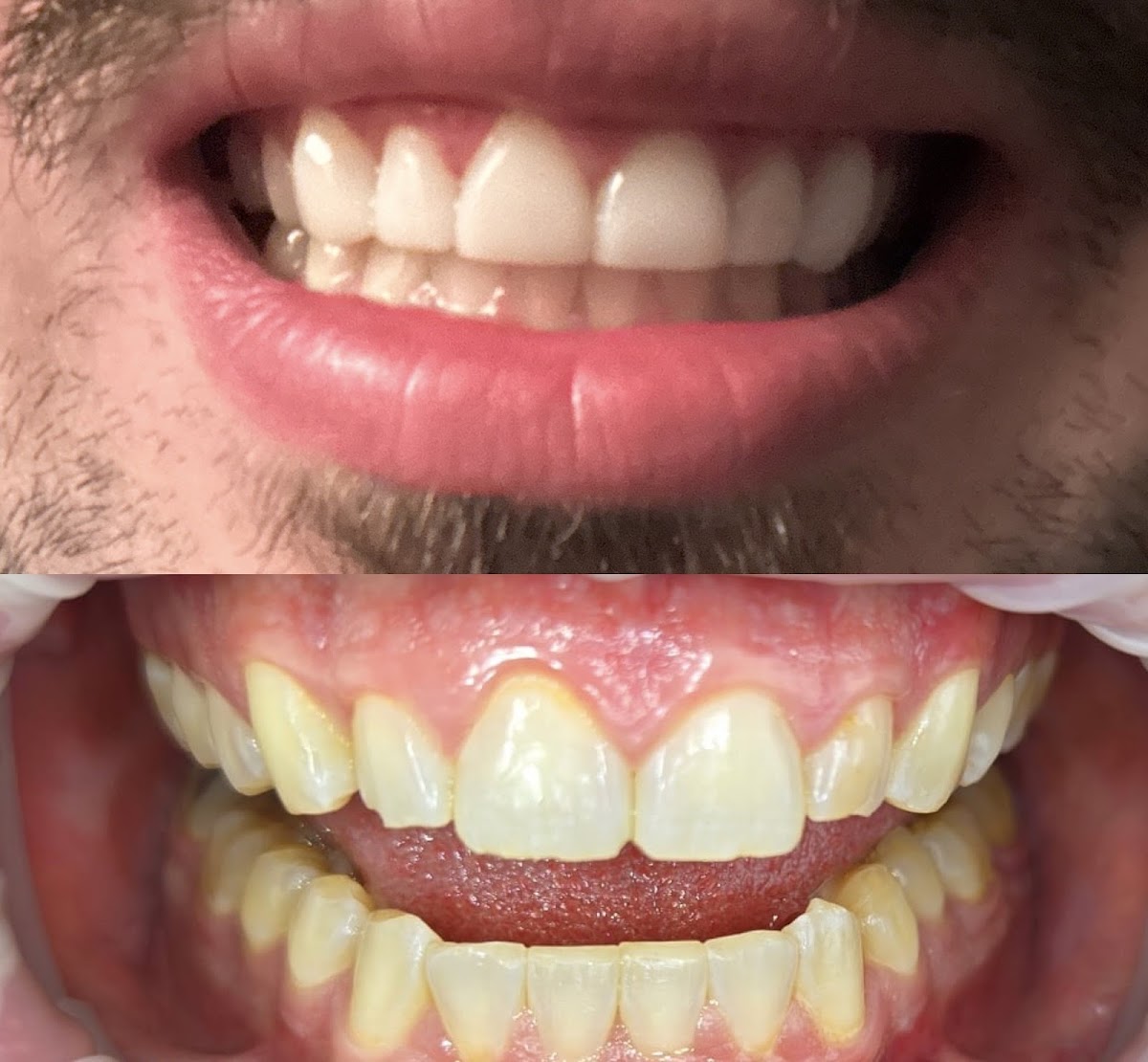 Pleasant Valley Dentistry photo 6