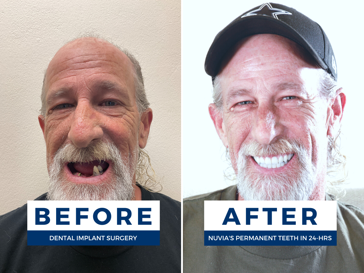 Nuvia Dental Implant Center - Denver photo 5