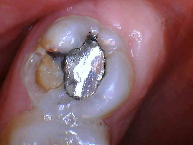 Lone Oak Dental photo 5