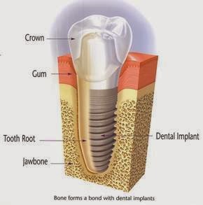 Hudson Valley Dental Implants & Periodontics photo 3