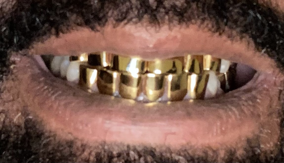 Gold Teeth and Gems of La photo 1