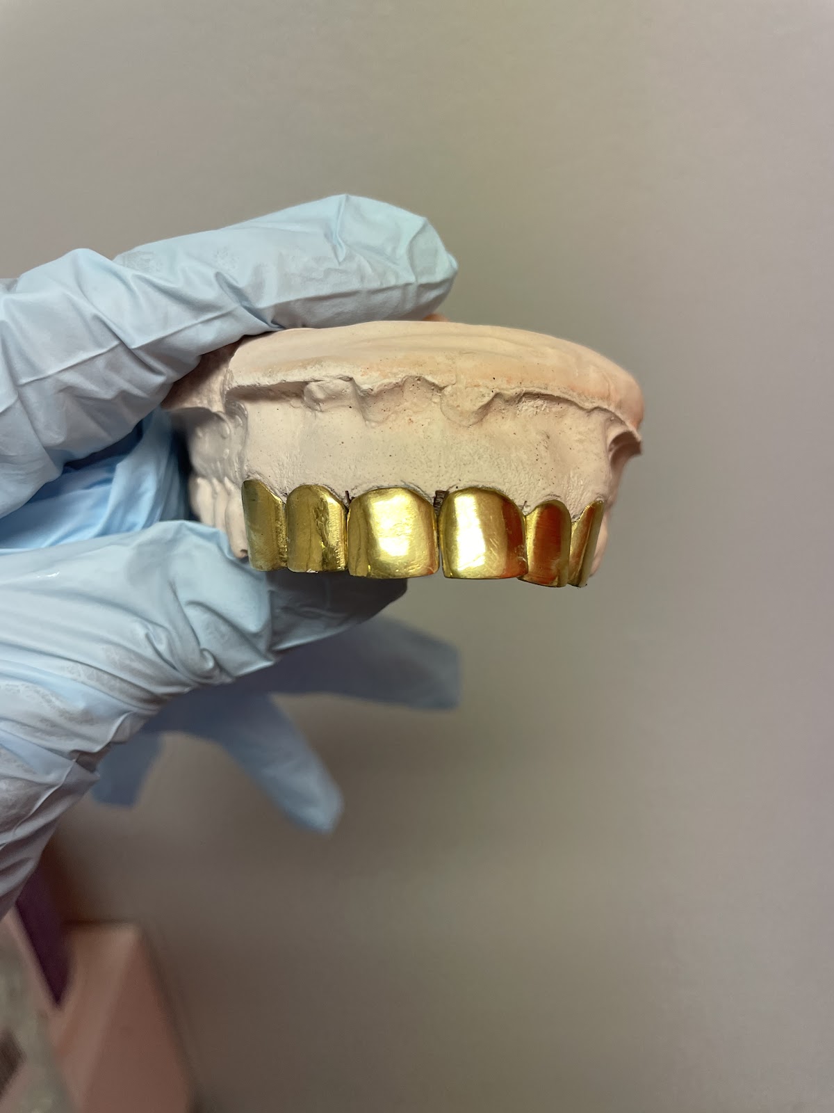Gold Teeth and Gems of La photo 2