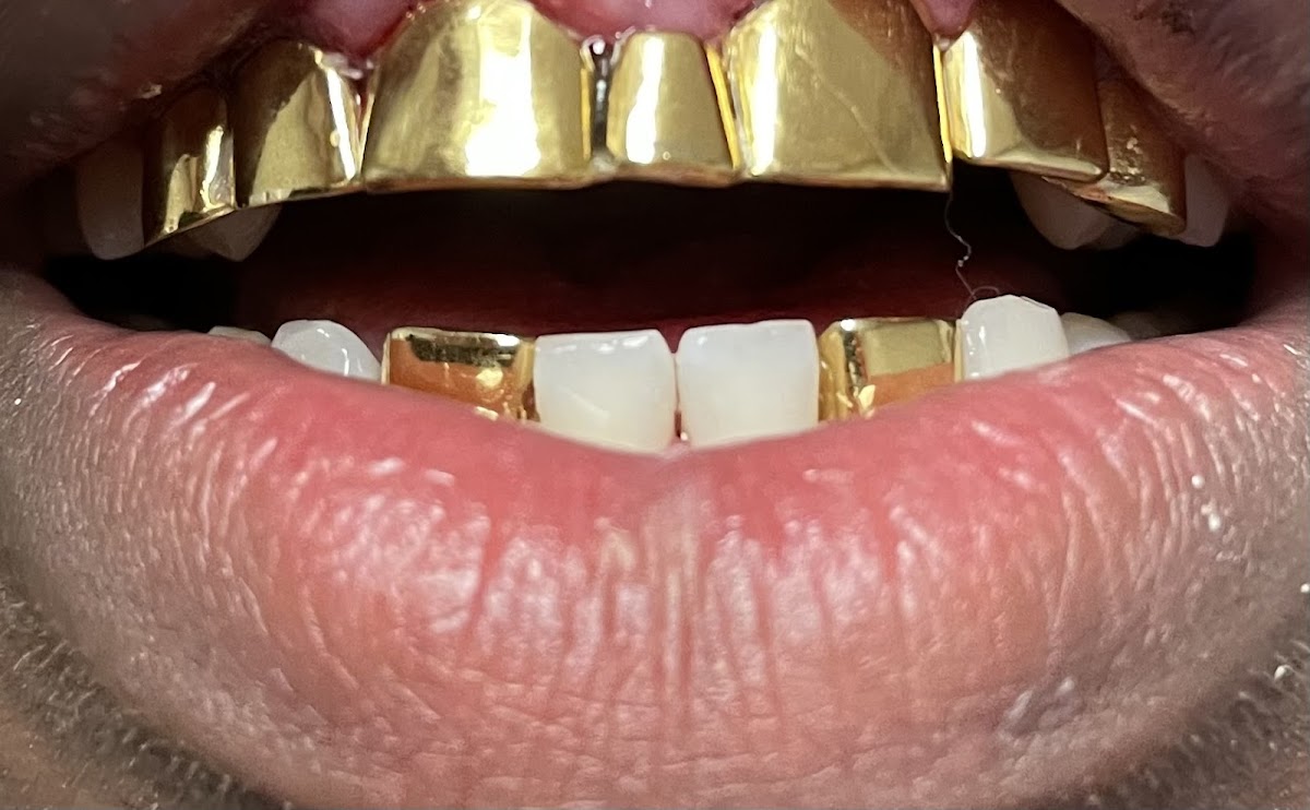 Gold Teeth and Gems of La photo 4