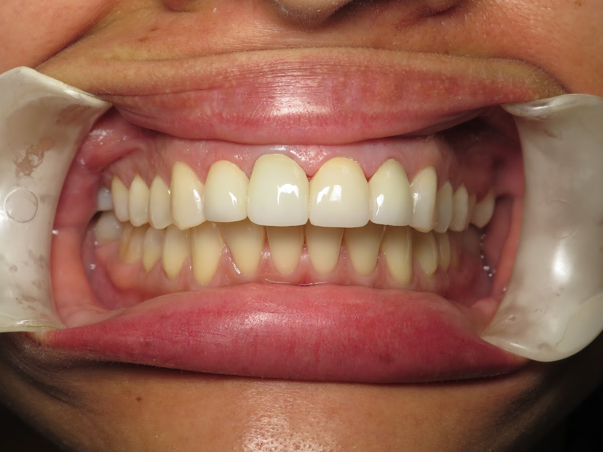 Golden West Dentistry photo 1