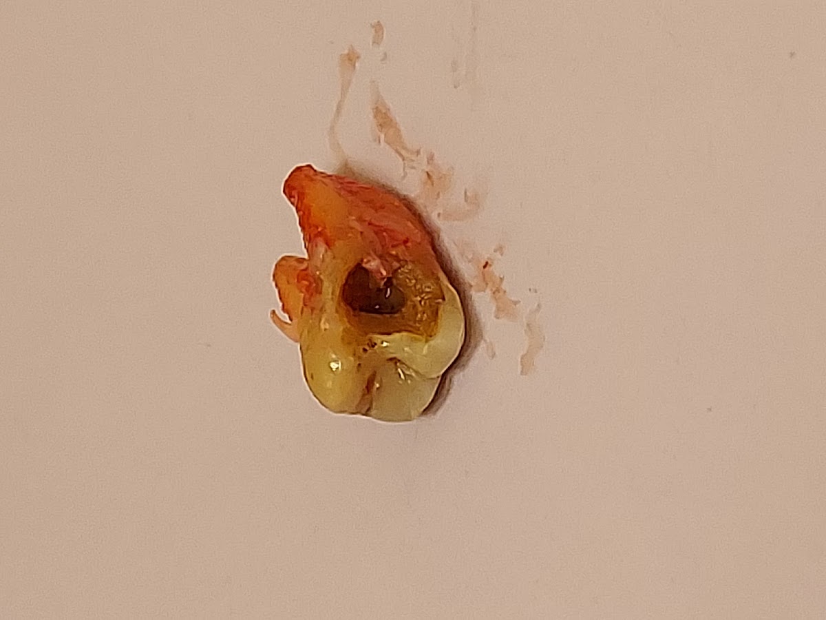 Aspen Dental - Wyomissing photo 3