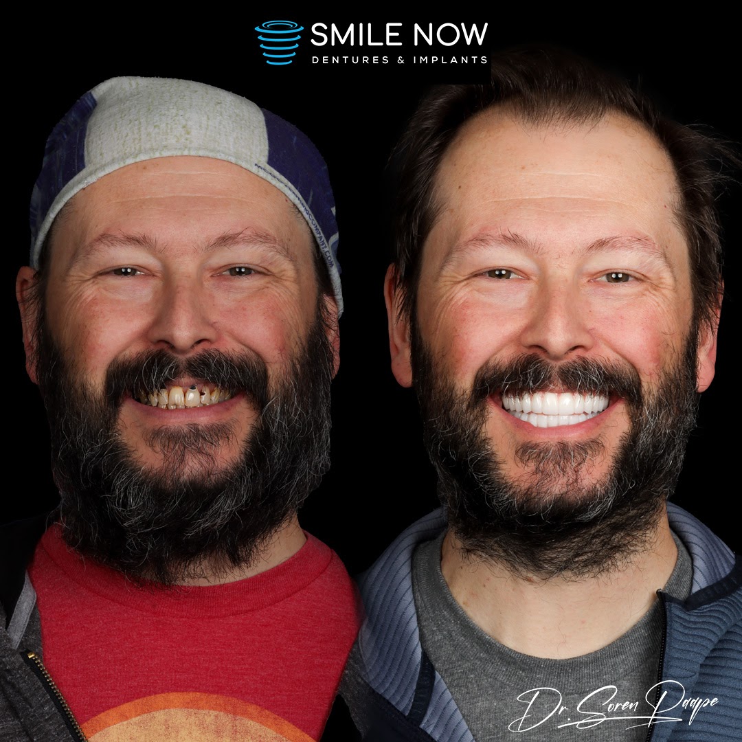 Smile Now Denver Dentures and Implants photo 4