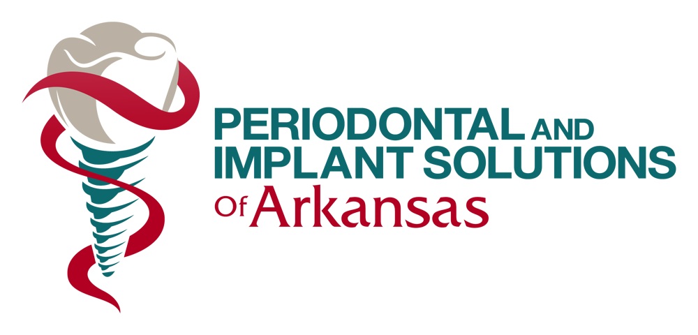 Periodontal and Implant Solutions of Arkansas photo 4