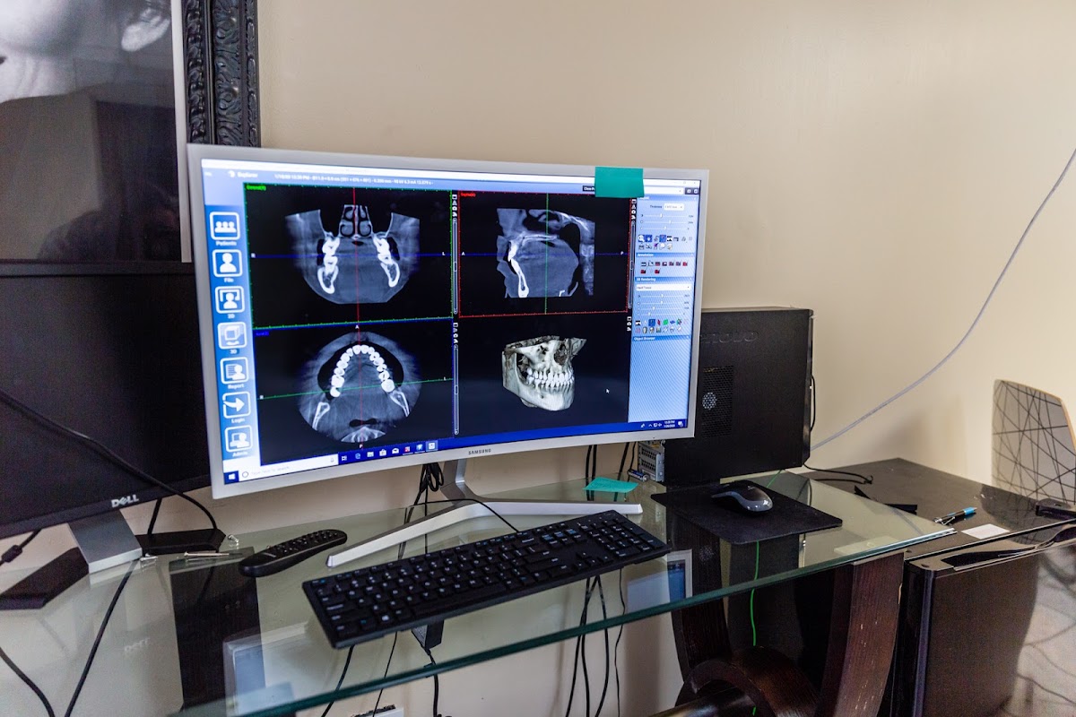 Ismile Dental and Implants photo 6