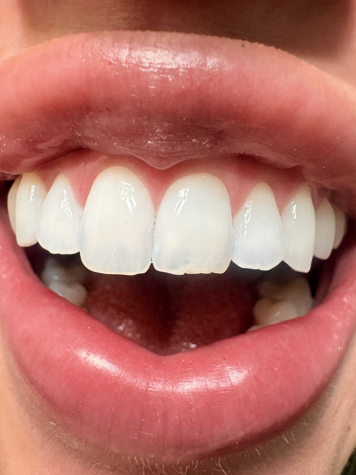 Celebrate Dental & Braces - Independence photo 1