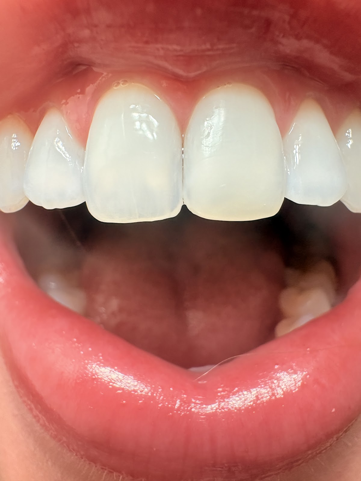 Celebrate Dental & Braces - Independence photo 6