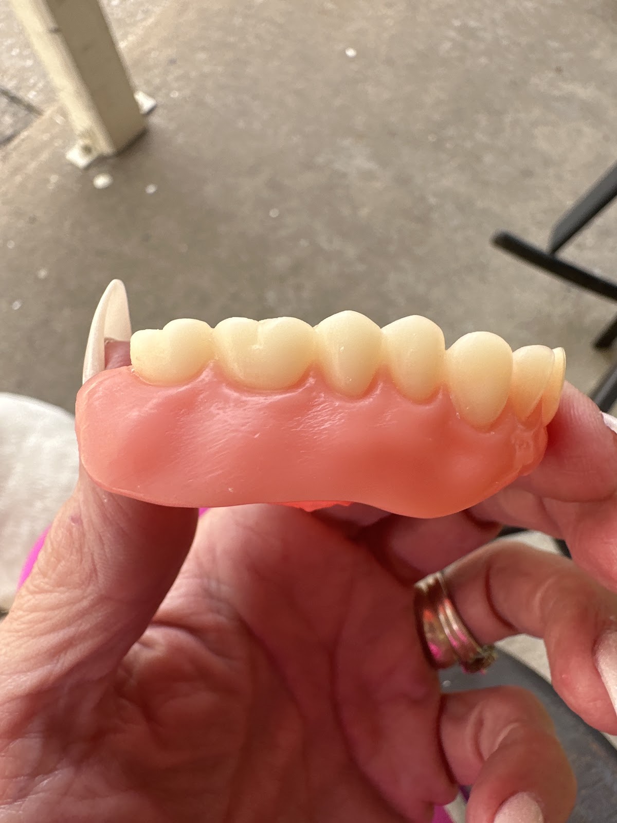 Aspen Dental - Mesquite photo 1
