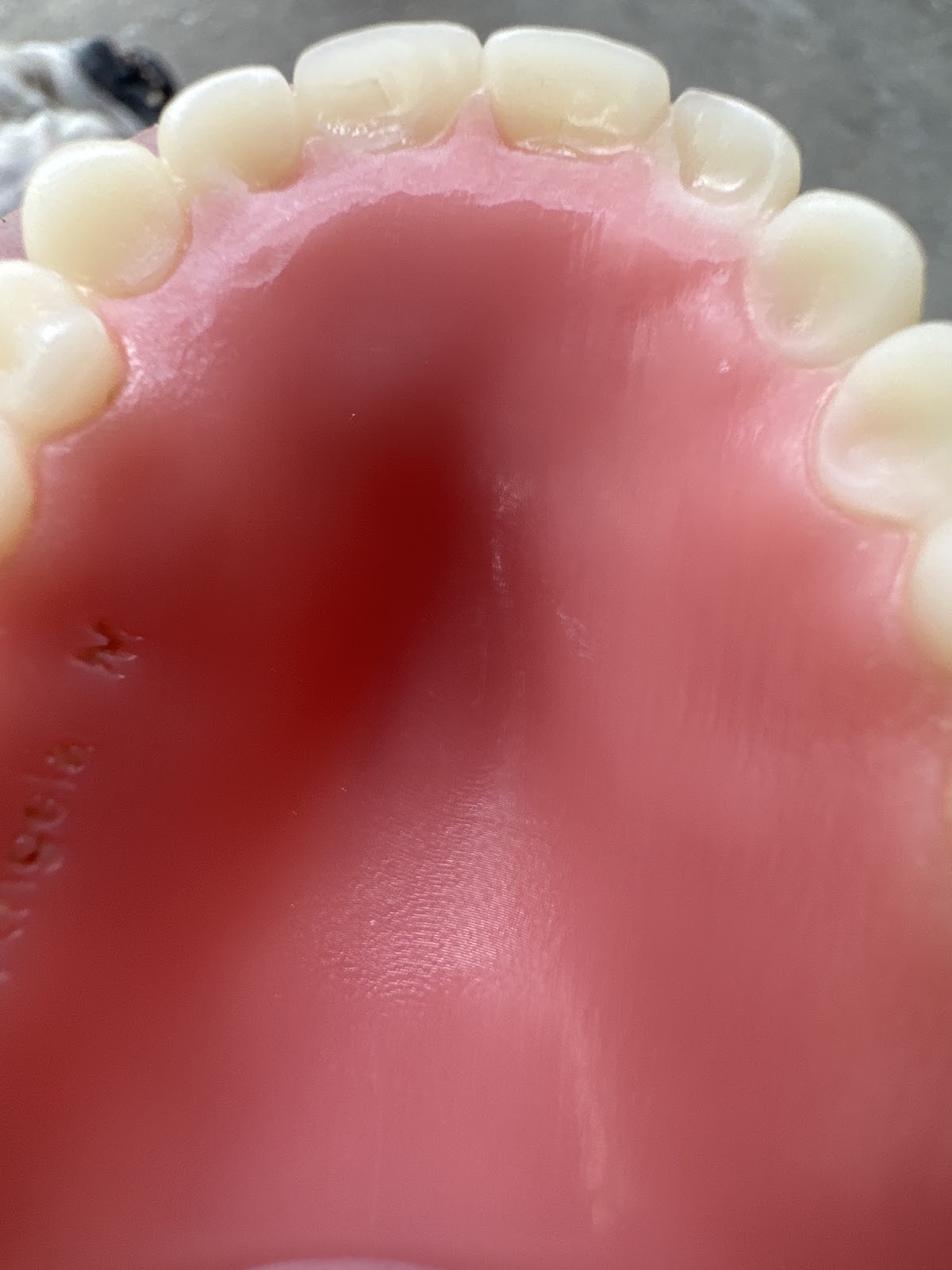 Aspen Dental - Mesquite photo 4