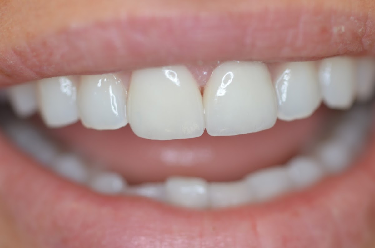 Pacific View Smile Center photo 1
