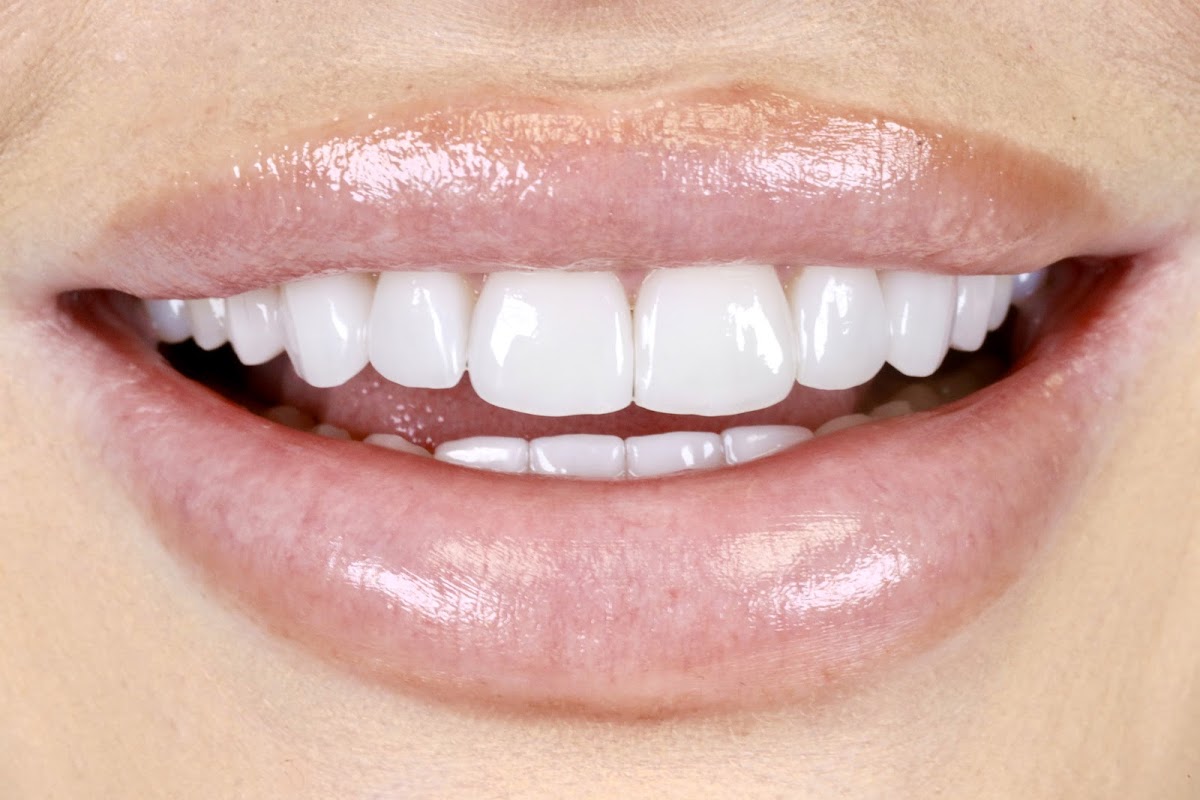 True Dentistry - Las Vegas photo 1