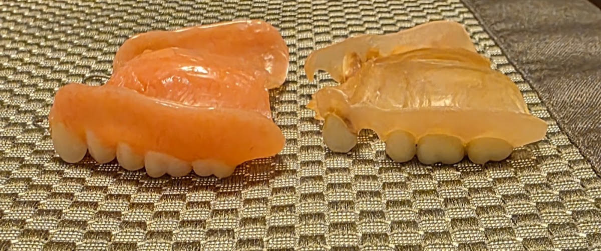 Affordable Dentures & Implants - Belton photo 3