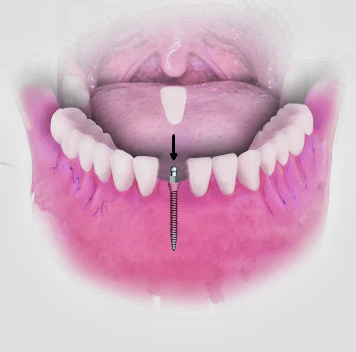 Dental Implant Solutions of Clinton Township Mi photo 1