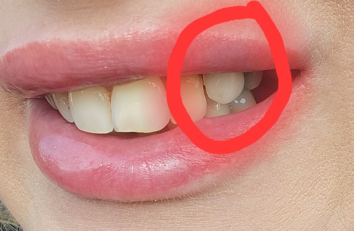 Affordable Dentures & Implants - Arlington photo 4