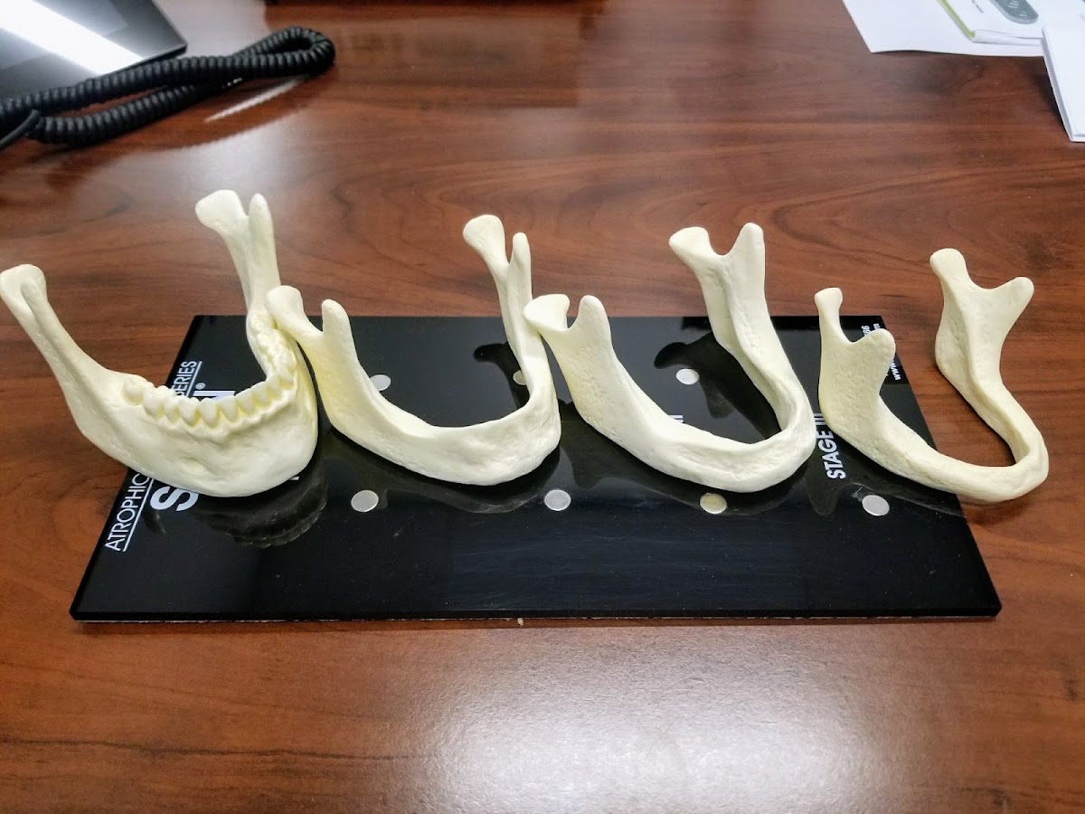 Affordable Dentures & Implants - Arlington photo 5