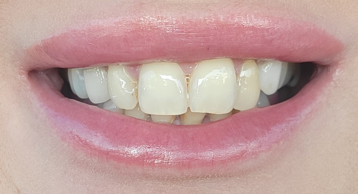 Affordable Dentures & Implants - Arlington photo 6