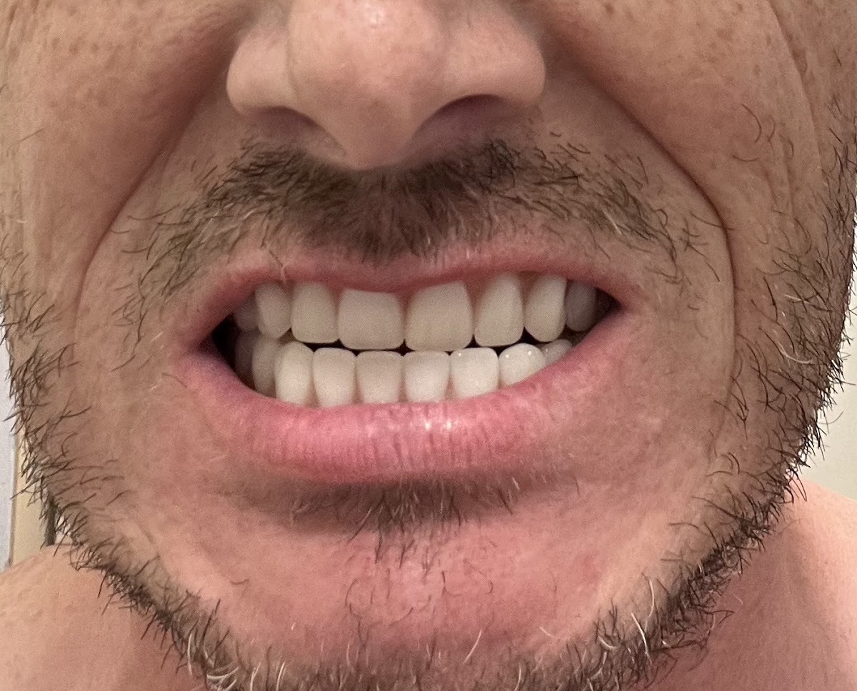 Affordable Dentures & Implants photo 4