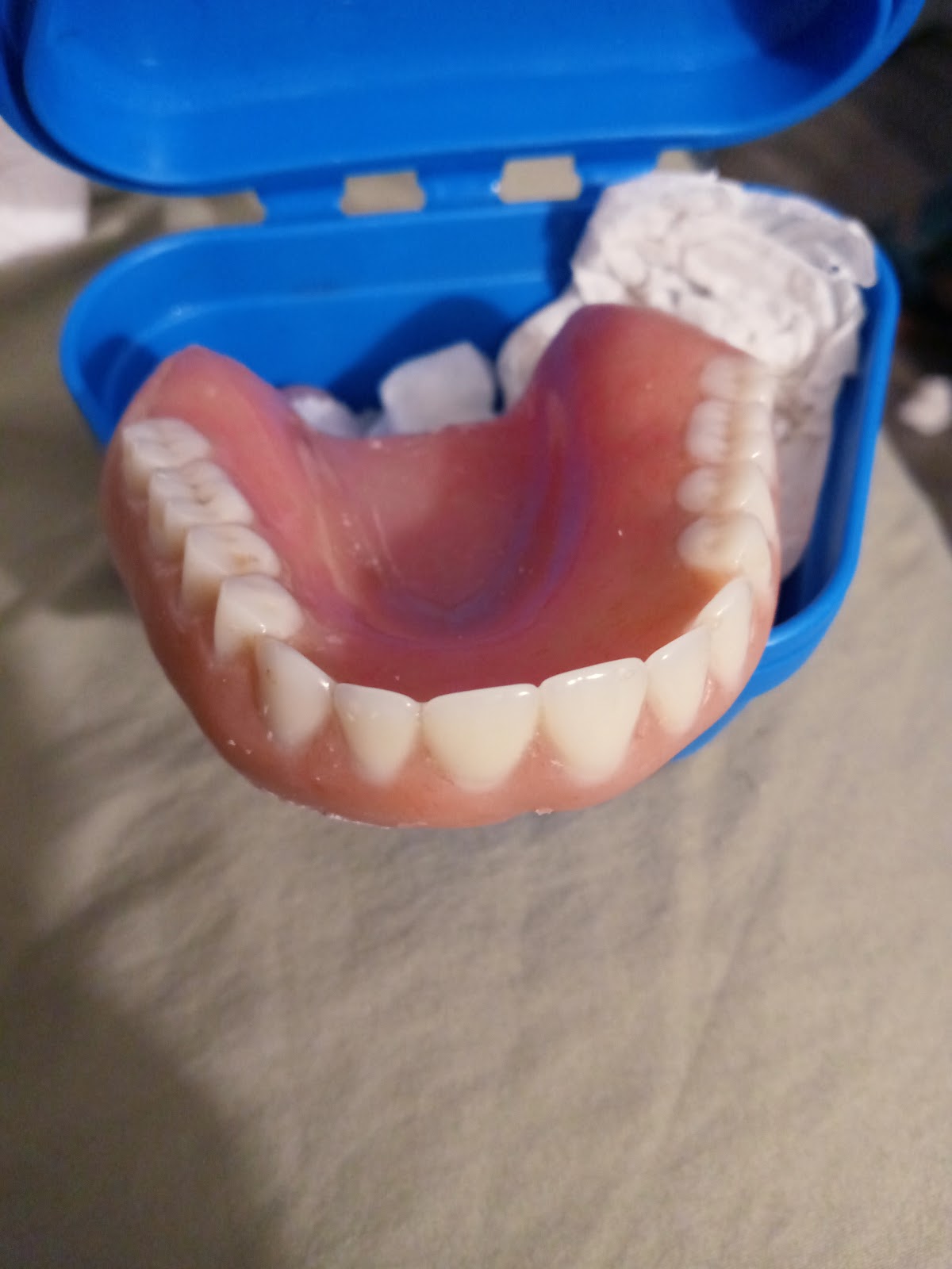 Affordable Dentures & Implants photo 5