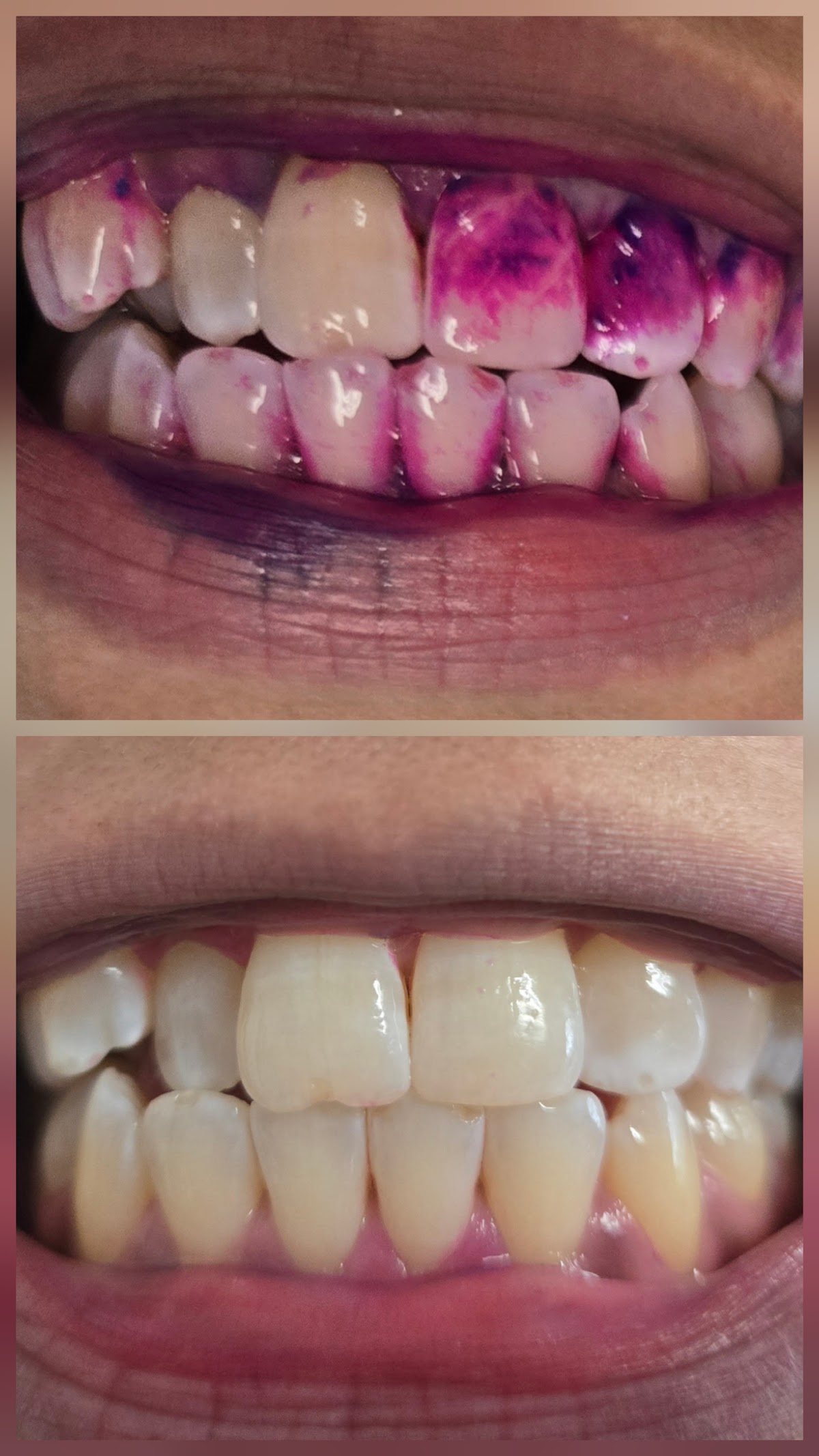 Cleveland Family & Implant Dentistry-mini Dental Implant Center of Cleveland photo 6