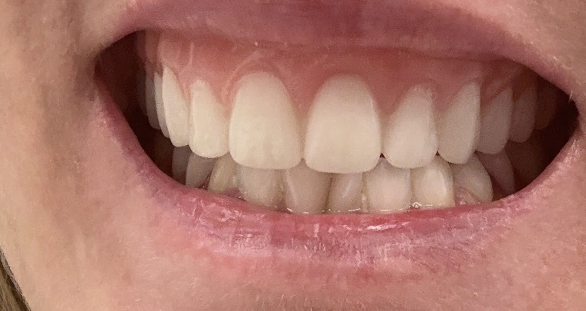 Aspen Dental - Winchester photo 2