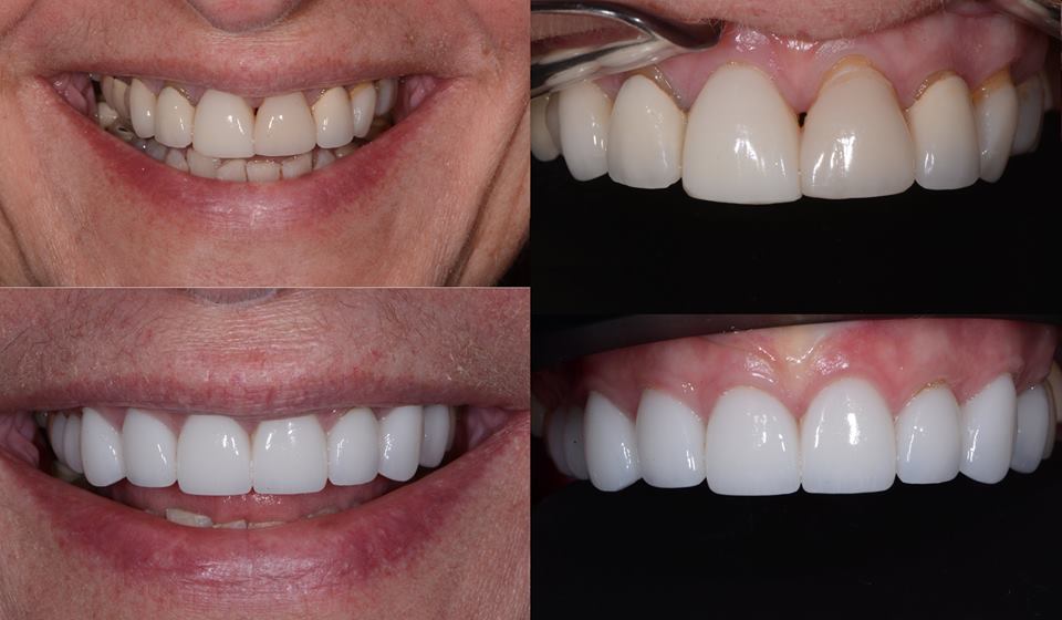 Saratoga Springs Family Dentistry photo 3