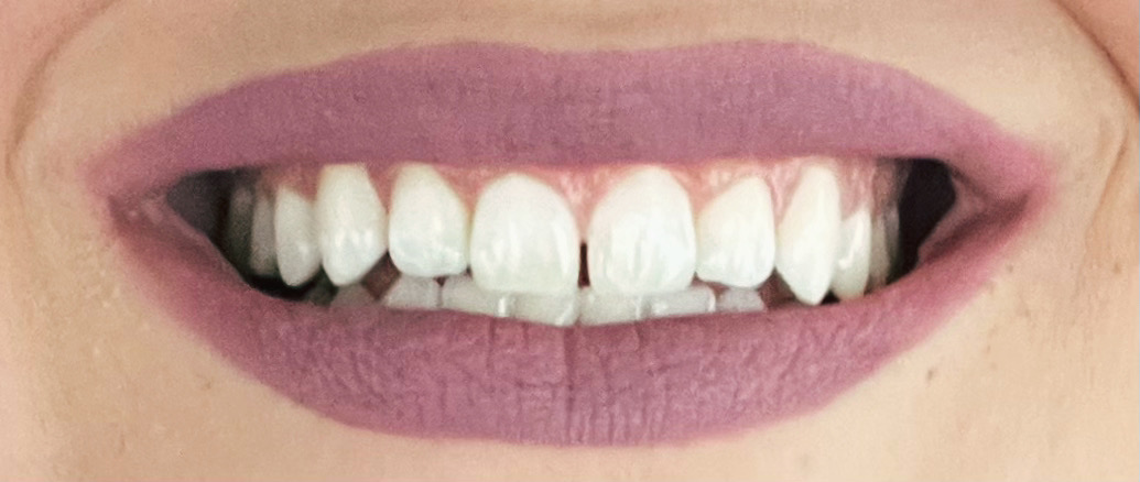 Schonfield Dental photo 2