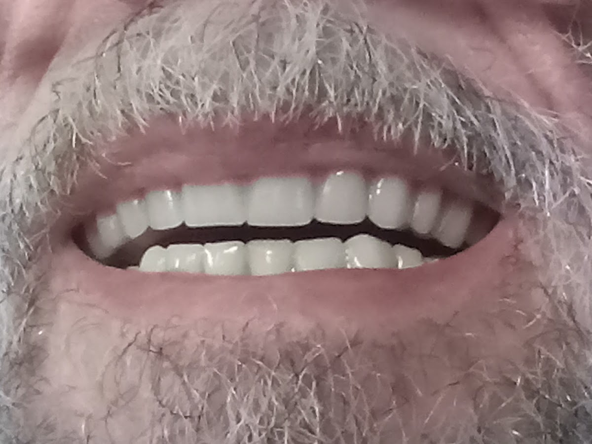 Mountain Empire Dental photo 2