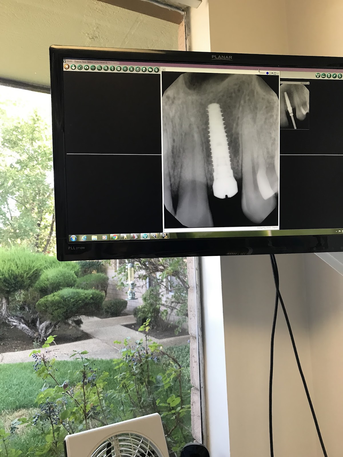 Steven D. Robinson, DDS photo 1