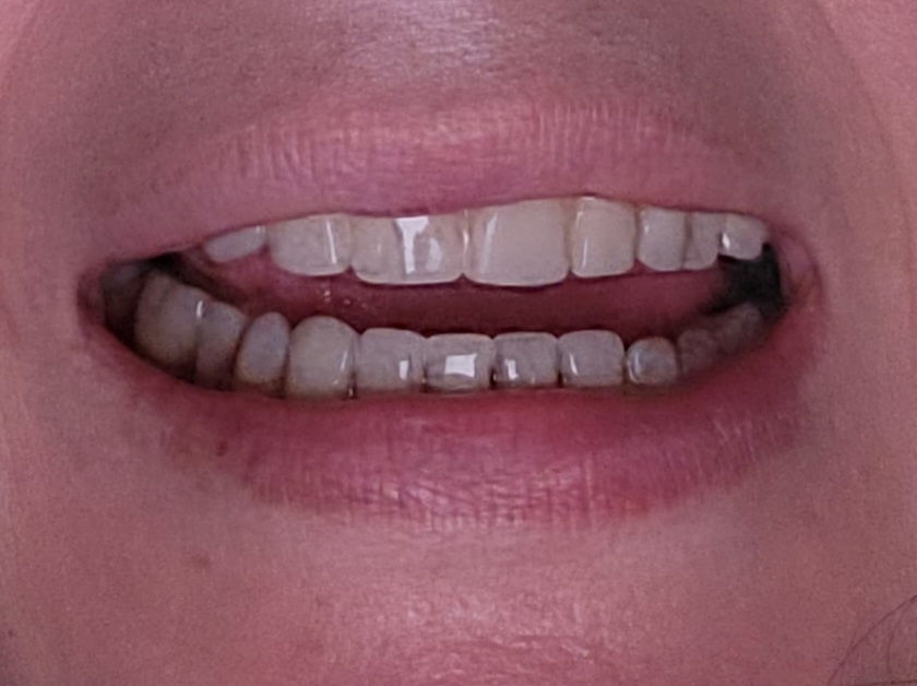 Dental Corner photo 6