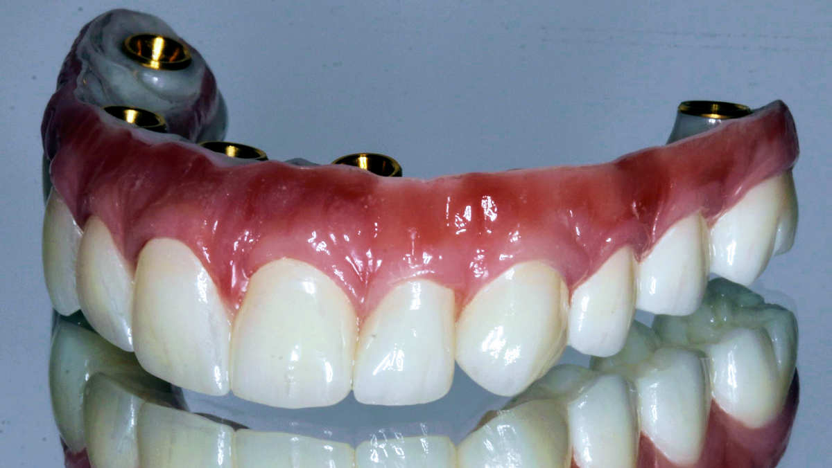 Marin Dental Implant Center photo 1