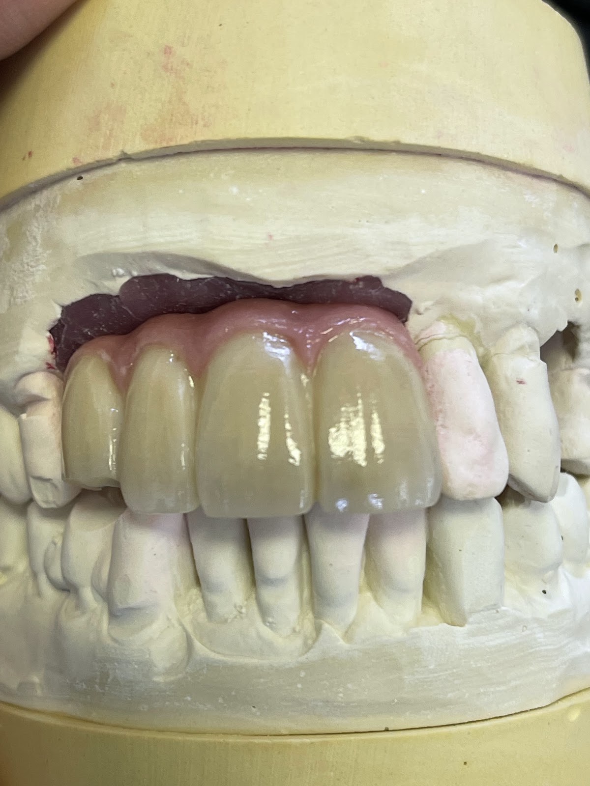 Marin Dental Implant Center photo 2