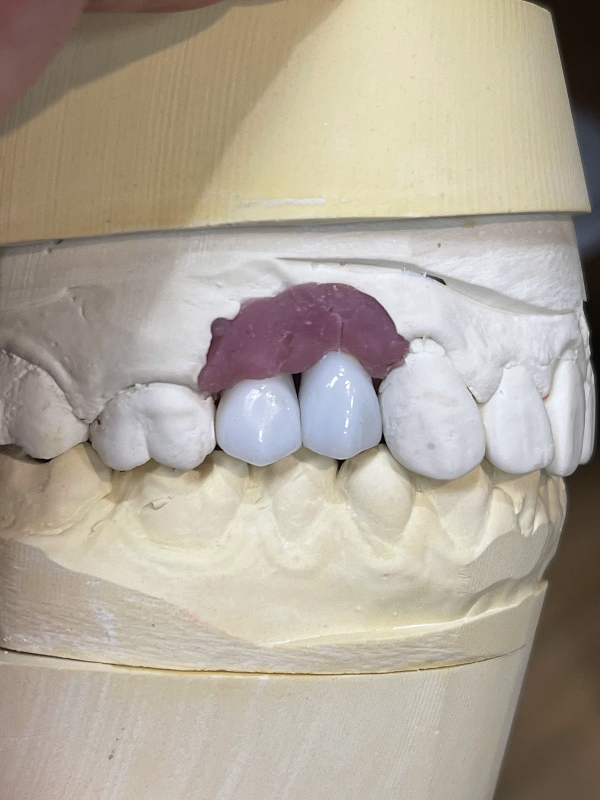 Marin Dental Implant Center photo 3