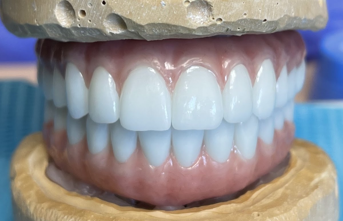 Marin Dental Implant Center photo 5