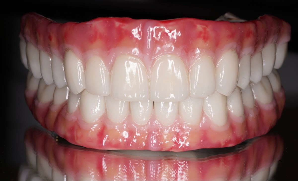 Marin Dental Implant Center photo 6